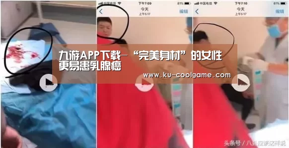九游APP下载-“完美身材”的女性更易患乳腺癌(图2) 九游官方入口